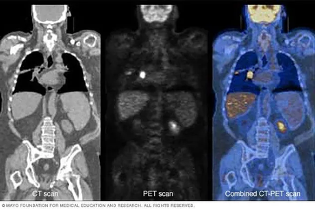 pet-ct-mri-scan pet-ct-mri-scan
