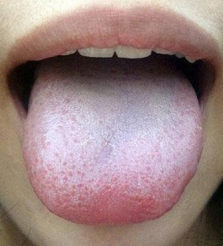 What Your Tongue Says About Your Health: 10 Warning Signs What Your Tongue Says About Your Health: 10 Warning Signs