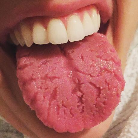 What Your Tongue Says About Your Health: 10 Warning Signs What Your Tongue Says About Your Health: 10 Warning Signs