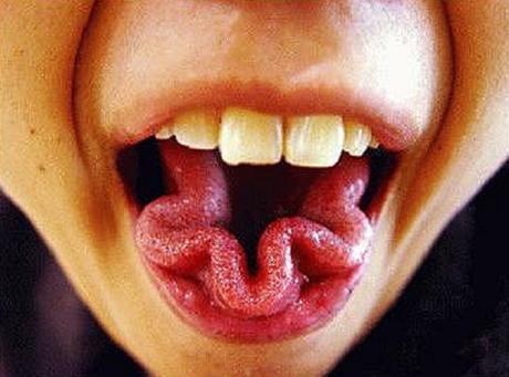 What Your Tongue Says About Your Health: 10 Warning Signs What Your Tongue Says About Your Health: 10 Warning Signs