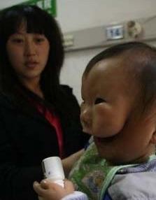 Small Chinese Boy Born With a Mask on Face Unbelievable 1