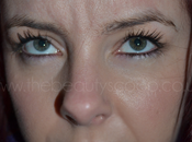 Botox Diaries Re-Ehnance Clinic Hale!