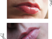 Kiss Worthy Lips Eles