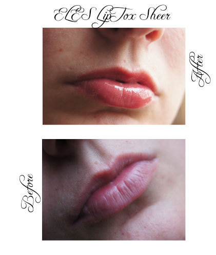 Kiss worthy lips | Eles