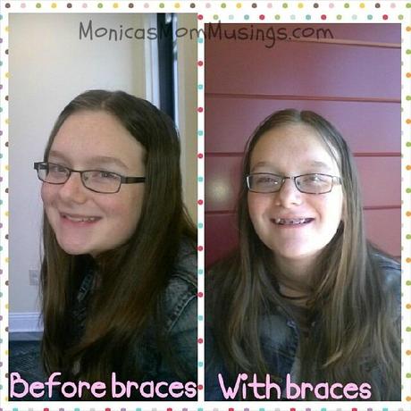 BeforeWith braces