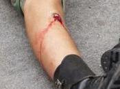 Florida Lawful Owner Shoots Himself Accidentally After Attending Safety Class