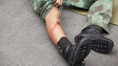 Gunshot wound to the leg via Shutterstock