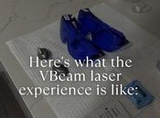 Tried VBeam Laser Here Experience