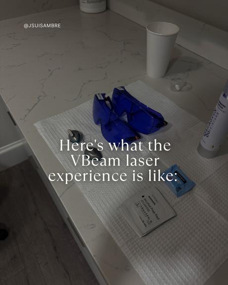 I tried the VBeam Laser - Here is my experience