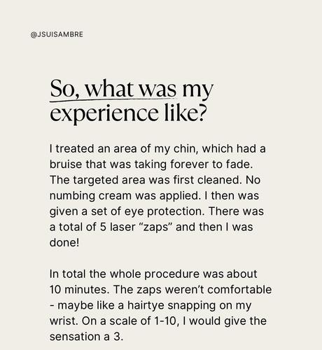 I tried the VBeam Laser - Here is my experience