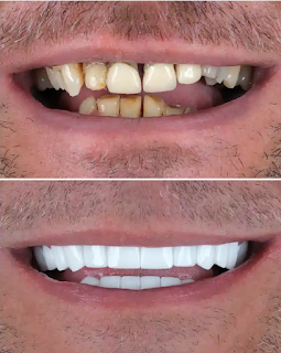 Summertime, and The Living is Easy? Summertime, and The Living is Easy?