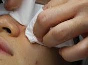 Should Best Extraction Facial Singapore Deep Pore Cleansing