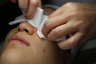 Why You Should Try the Best Extraction Facial in Singapore for Deep Pore Cleansing Why You Should Try the Best Extraction Facial in Singapore for Deep Pore Cleansing