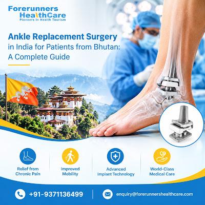 Ankle Replacement Surgery in India for Patients from Bhutan: A Complete Guide surgery cost in india for bhutanese patients