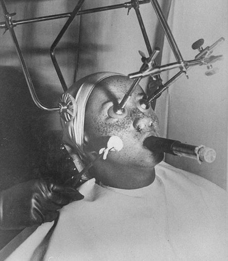 Unusual and Bizarre Beauty Devices From The Past