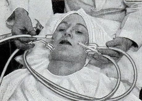 Unusual and Bizarre Beauty Devices From The Past