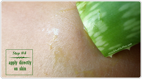 Aloe Vera for Scars