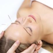 Things You Really Need to Know About Acupuncture