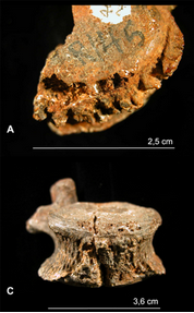 The vertebra of the Austrlaopithecus africanus with lesions
