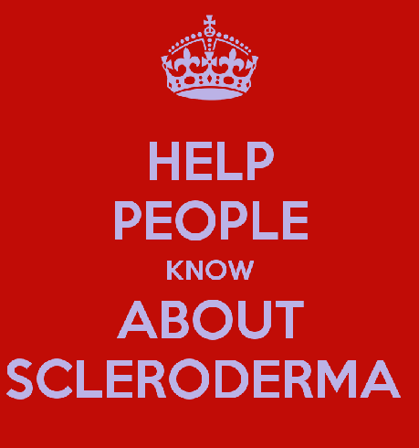 In the Spotlight.....Scleroderma (Systemic Sclerosis)