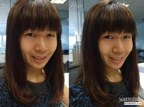 skii whitening spots specialist before after