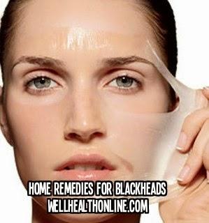 Home Remedies For Blackheads