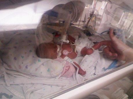 My Twins Were Born At 26 Weeks