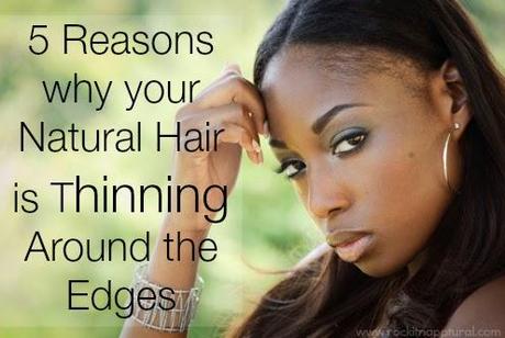 5 Reasons Why Your Natural Hair Is Thinning Around The Edges
