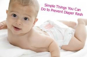 Simple Things You Can Do to Prevent Diaper Rash