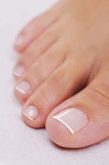 Getting Rid of Nail Fungus and Yellow Stains