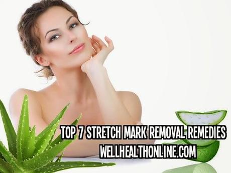 Top 7 Stretch Mark Removal Remedies