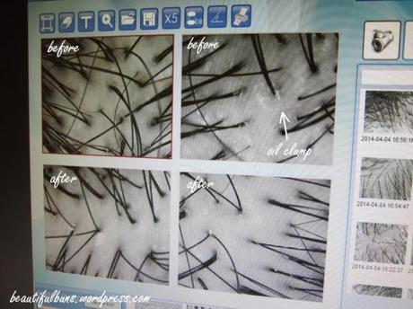 PHS Hair Science DSR (15)