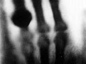 X-Ray