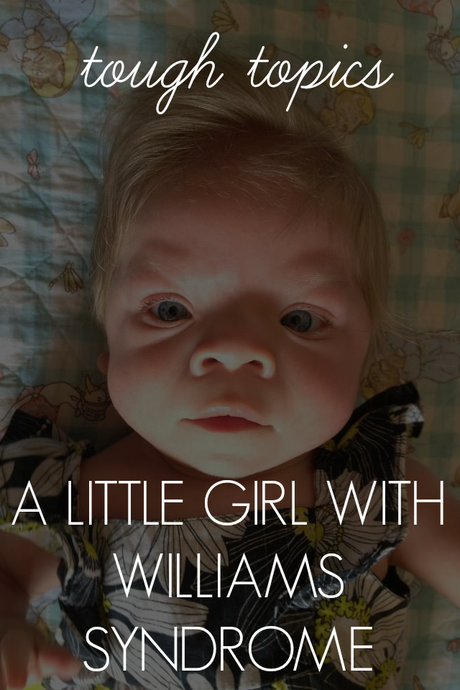 A Little Girl With Williams Syndrome