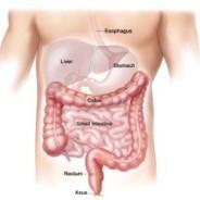 Try Natural Treatment To Prevent Colon Cancer