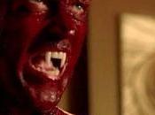 Stephen Moyer Nails Biggest True Blood Spew Scene: “The Bellagio”