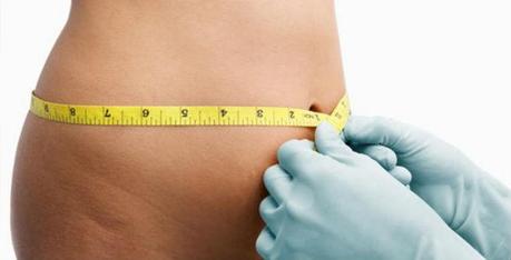 Tumescent Liposuction