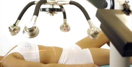 zerona-laser-treatment-1