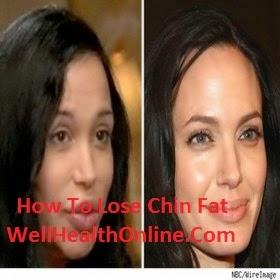 Double Chin Reduction - How To Lose Chin Fat