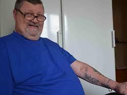 Needle lost in tattooist’s body removed 40 years later