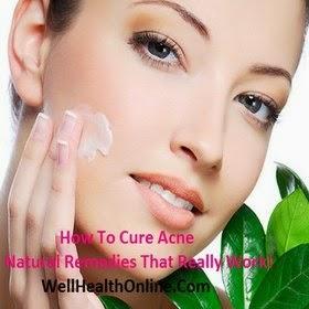 How To Cure Acne: Natural Remedies That Really Work!