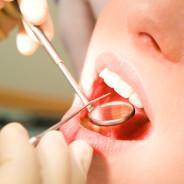 Tips To Choosing A Dental Insurance Plan