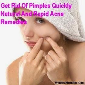 How To Get Rid Of Pimples Quickly - Natural And Rapid Acne Remedies