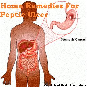 Home Remedies For Peptic Ulcer
