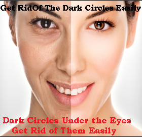 Get Rid of The Dark Circles Easily