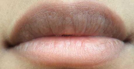Lip Pigmentation