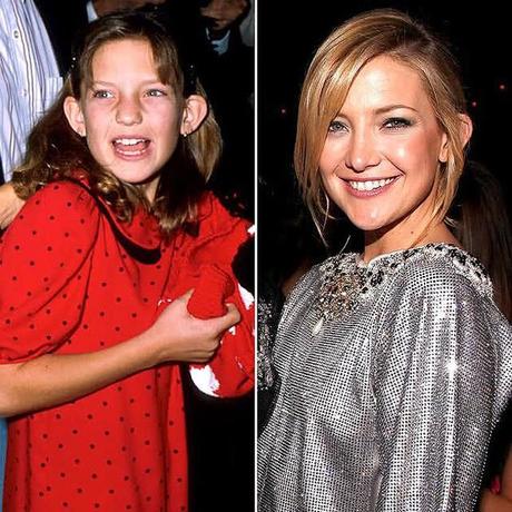 What Did Celebrities Look Like As Children