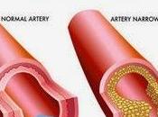 Easy Natural Ways Lower Your Cholesterol