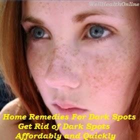 Home Remedies For Facial Dark Spots