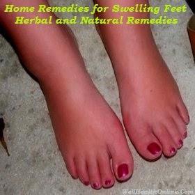 Home Remedies for Swelling Feet